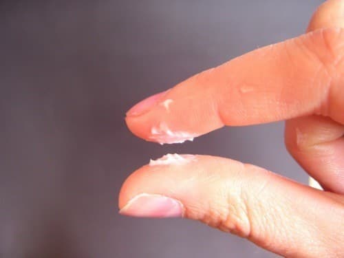 Khí hư vón cục như bã đậu nguyên nhân do đâu?