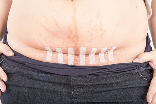 sinh-mo-co-anh-huong-toi-suc-khoe-2