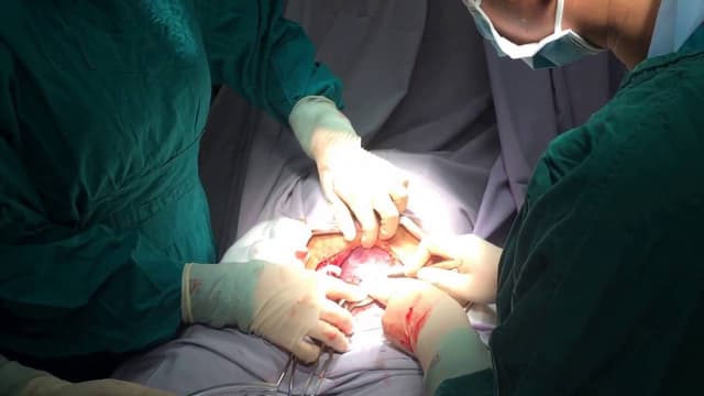 Sinh mổ lần 3 cách lần 2 bao lâu?