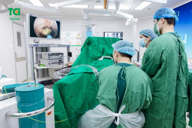 Biện pháp để loại bỏ sỏi niệu quản triệt để không mổ