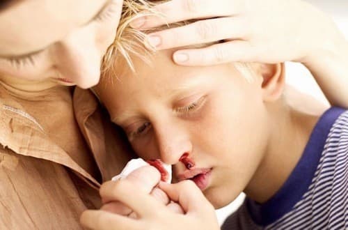 trẻ chảy máu cam phải làm sao