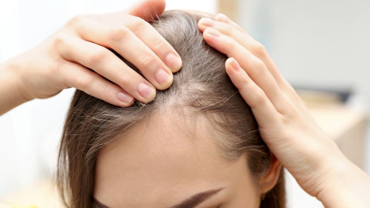 Vì sao hóa, xạ trị ung thư lại rụng tóc