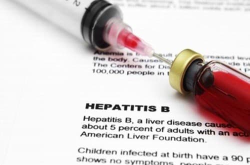 Kết quả xét nghiệm HBsAg dương tính người bệnh đừng quá lo lắng