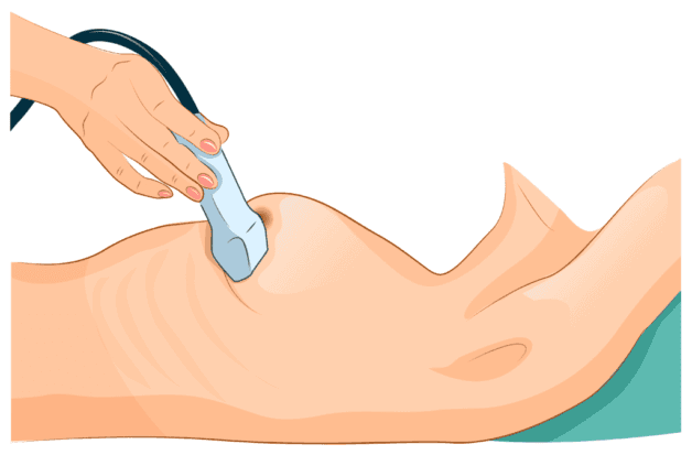 Siêu âm tuyến vú chi phí bao nhiêu