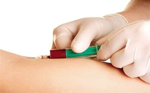 mẹ bầu cần đi khám thai định kỳ, thực hiện sàng lọc và chẩn đoán cần thiết khi mang thai.