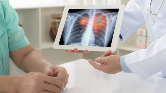 Bị bệnh ung thư có chết không?