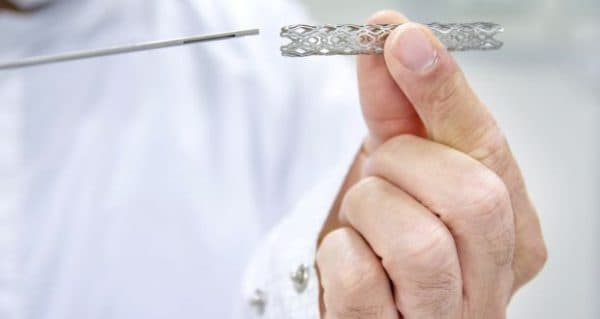 Đặt stent thực quản có thể khiến bệnh nhân ăn uống dễ chịu