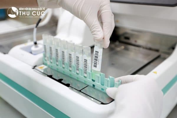 Xét nghiệm máu trong phân 