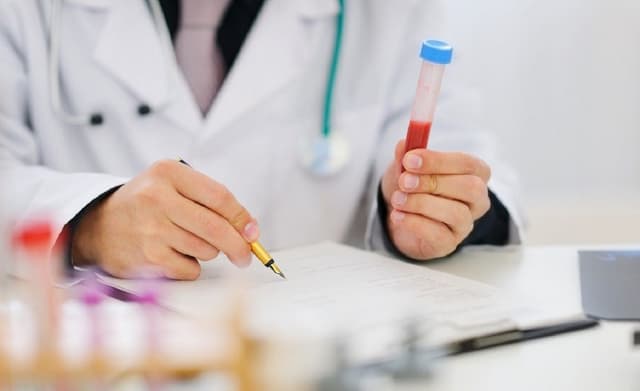 Chỉ số Tg trong xét nghiệm máu có ý nghĩa gì?