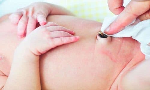 Thoát vị rốn ở trẻ nhỏ hiếm khi gây biến chứng.