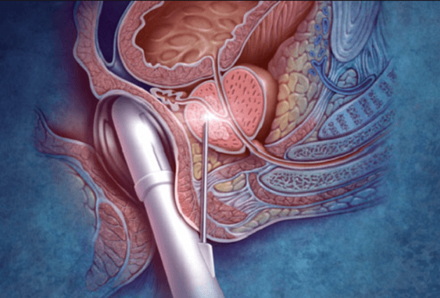 có nhiều cách khám trực tràng khác nhau