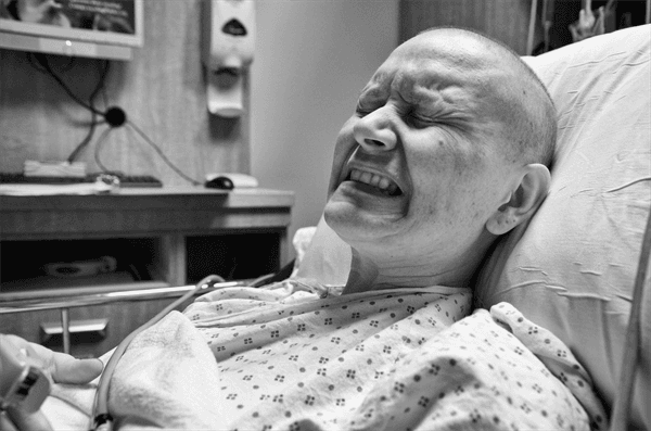 Đau đớn là triệu chứng ung thư dạ dày di căn xương điển hình