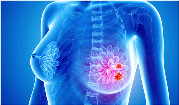 dân văn phòng dễ mắc ung thư