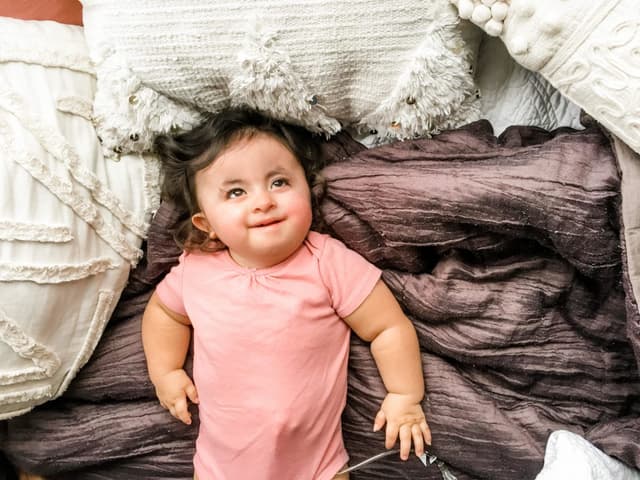 Trisomy 18 là gì, mẹ bầu đã biết?