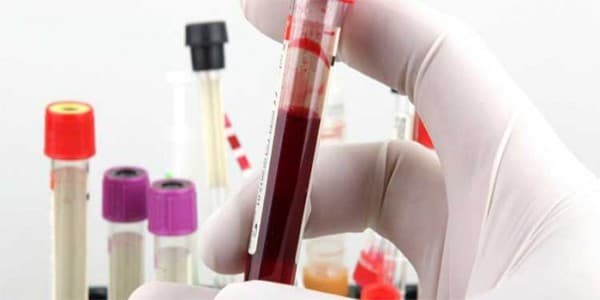 Anti HBs là gì? Anti HBs bao nhiêu là bình thường?