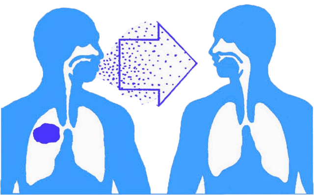 Bệnh lao phổi có lây không? nguyên nhân nào gây nên