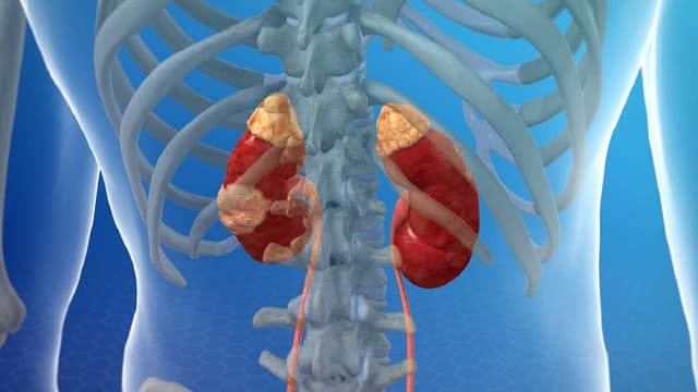 Triệu chứng của bệnh ung thư thận