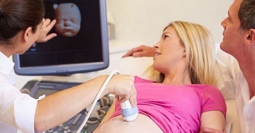 Khuôn mặt, làn da, các bộ phận trên cơ thể bé, sự chuyển động của bé... mẹ có thể nhìn thấy rõ ràng hơn.