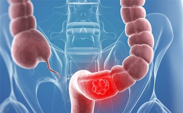 tác dụng của tập thể dục