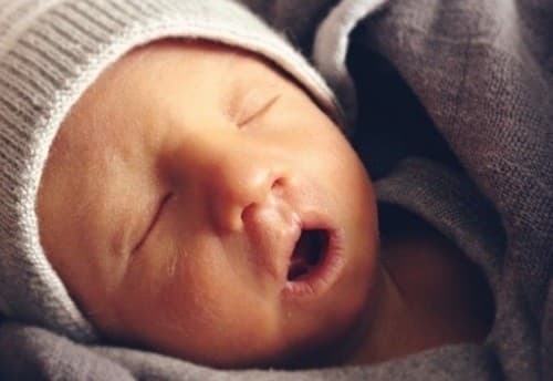 Mắc hội chứng Edwards, trẻ có nhiều vấn đề nghiêm trọng về sức khỏe. 