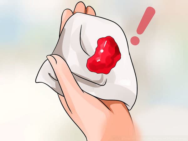 ung thư đại tràng giai đoạn cuối