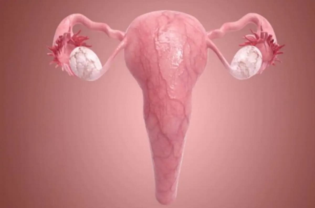 Tắc vòi trứng là bệnh gì?