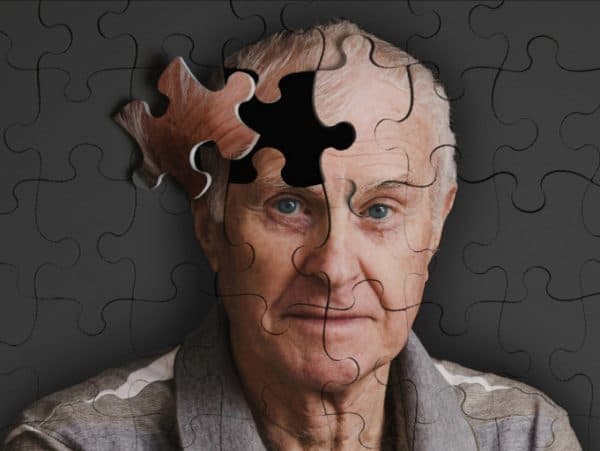 nguyên nhân gây bệnh Alzheimer do các tế bào não bị chết hoặc tổn thương.
