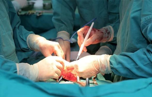 Bác sĩ phẫu thuật có thể loại bỏ những tác nhân gây tắc nghẽn ống tiêu hóa, chỉnh sửa đoạn tắc nghẽn hoặc cắt bỏ một phần ruột đã hỏng. 