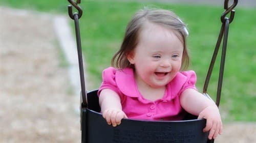 Trisomy 21 gây ra hội chứng Down ở người