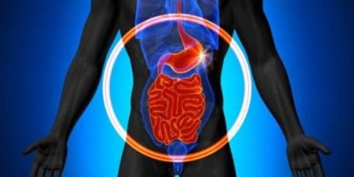 Viêm thực quản trào ngược và những điều cần biết