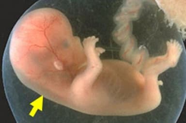 Xét nghiệm độ mờ da gáy có ý nghĩa gì?