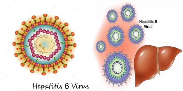 Điều trị viêm gan B