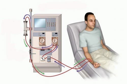 Chạy thận cần được thực hiện theo đúng chỉ định của bác sĩ
