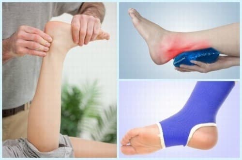 Cố định chân và chườm lạnh để điều trị bong gân mắt cá chân