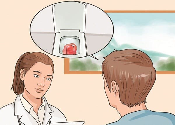 Đi ngoài ra máu là một trong những triệu chứng phổ biến nhất thường thấy ở bệnh nhân có polyp đại tràng