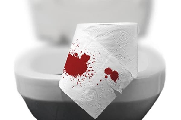 Đi ngoài phân có máu là một trong những triệu chứng điển hình ở bệnh nhân ung thư trực tràng