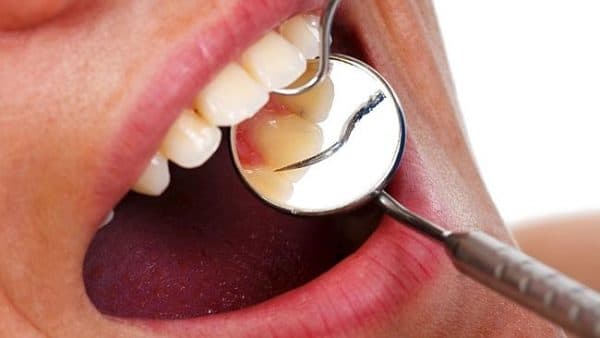 nguyen-nhan-dan-den-viem-loi-1