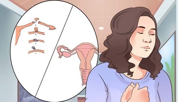 Nguyên nhân tắc vòi trứng chủ yếu là do nhiễm khuẩn âm đạo, cổ tử cung