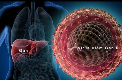 5 Nguyên nhân ung thư gan ĐIỂN HÌNH mà nhiều người chủ quan