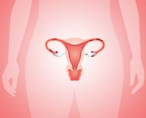 Nội mạc tử cung dày bao nhiêu là có thai?