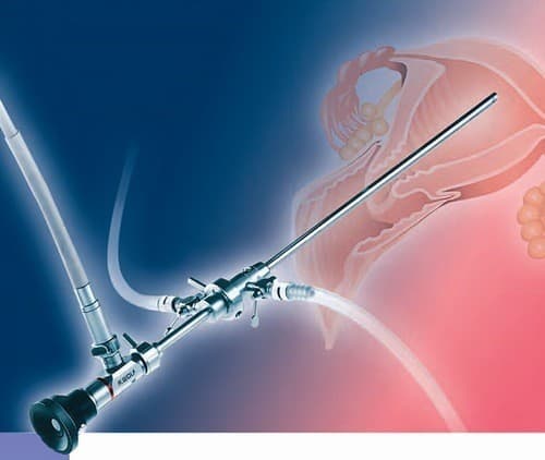 Nội soi buồng tử cung là thủ thuật được dùng chẩn đoán hoặc điều trị một số bệnh lý tại tử cung. 