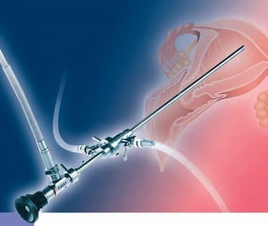 Nội soi buồng tử cung “tất tần tật” những thông tin cần biết