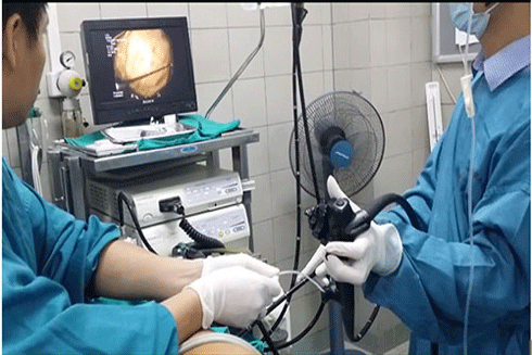 Ăn hồng ngâm khi đói dẫn đến tình trạng tắc ruột, gây tắc nghẽn đường tiêu hóa