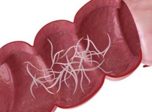 Để biết thêm thông tin chi tiết hoặc cần giải đáp thêm vềtắc ruột vì giun đũa, bạn đọc vui lòng liên hệ với Bệnh viện Đa khoa Quốc tế Thu Cúc  theo số điện thoại 024.383.55555 hoặc 1900 558892 hoặc hotline: 0936 388 288.