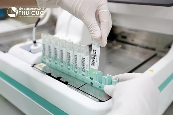 Xét nghiệm máu trong phân là xét nghiệm quan trọng trong tầm soát ung thư trực tràng trong cộng đồng