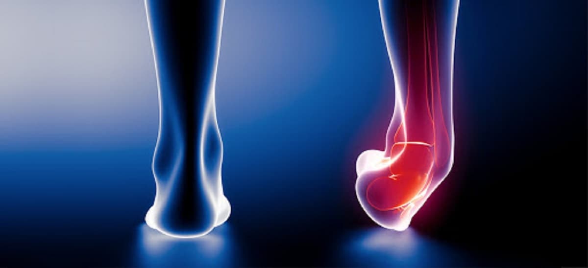 Trật khớp cổ chân phải làm sao? Điều trị như thế nào?