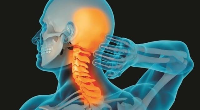 Triệu chứng bệnh thoái hóa đốt sống cổ