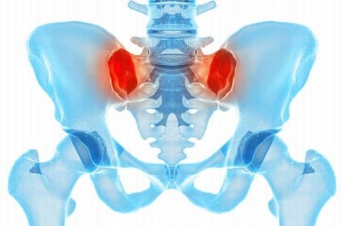 Triệu chứng viêm khớp cùng chậu