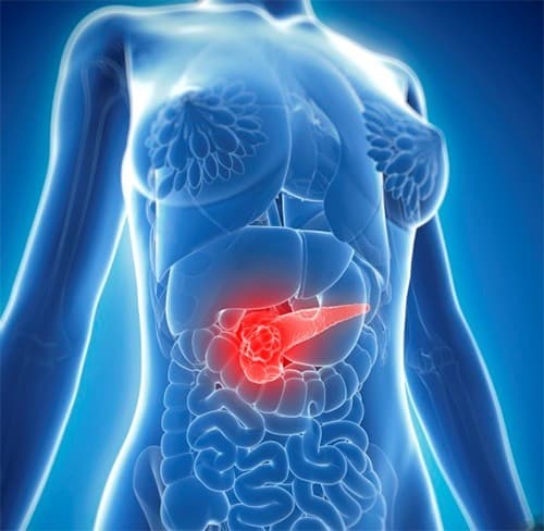 Tiên lượng sống của bệnh nhân ung thư tuyến tụy