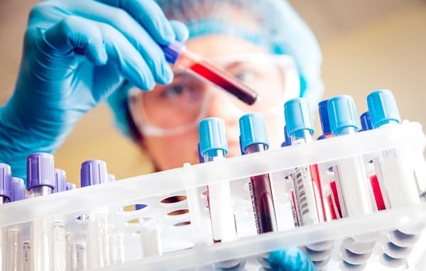 Giá trị CA 72 – 4 thường ở mức dưới 7 U/ml cho tất cả các nhóm tuổi, không phân biệt giới tính. 